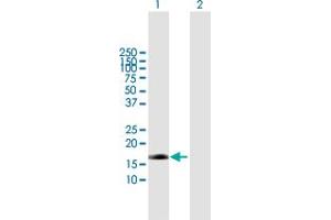 Western Blot analysis of EDN2 expression in transfected 293T cell line by EDN2 MaxPab polyclonal antibody. (Endothelin 2 anticorps  (AA 1-178))