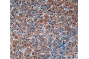 IHC-P analysis of liver tissue, with DAB staining. (Laminin alpha 1 anticorps  (AA 2613-2746))