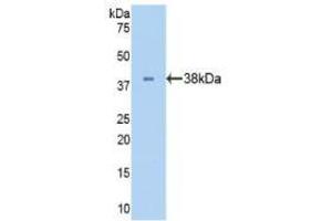 Western blot analysis of recombinant Human LDHB. (LDHB anticorps  (AA 1-334))