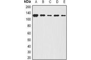 Western blot analysis of BOC expression in A431 (A), Hela (B), mouse lung (C), mouse brain (D), rat spinal cord (E) whole cell lysates. (BOC anticorps)