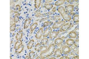 Immunohistochemistry of paraffin-embedded Mouse kidney using GLA Polyclonal Antibody at dilution of 1:100 (40x lens). (GLA anticorps)