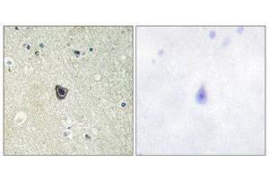 Immunohistochemistry (IHC) image for anti-Colony Stimulating Factor 1 Receptor (CSF1R) (Tyr809) antibody (ABIN1848010) (CSF1R anticorps  (Tyr809))