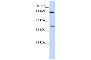 GTF2B antibody used at 0. (GTF2B anticorps  (C-Term))