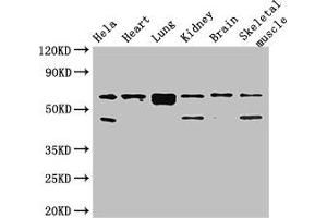 Western Blot Positive WB detected in: Hela whole cell lysate, Mouse heart tissue, Mouse lung tissue, Mouse kidney tissue, Mouse brain tissue, Mouse skeletal muscle tissue All lanes: PRKAA2 antibody at 2. (PRKAA2 anticorps  (Catalytic Subunit alpha))