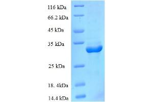 SDS-PAGE (SDS) image for CCHC-Type Zinc Finger, Nucleic Acid Binding Protein (CNBP) (AA 2-170) protein (His-SUMO Tag) (ABIN5709299)
