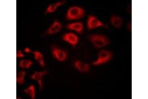 Immunofluorescent analysis of Tetranectin staining in Hela cells. (CLEC3B anticorps)