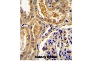 TLL2 Antibody (Center) (ABIN655266 and ABIN2844859) immunohistochemistry analysis in formalin fixed and paraffin embedded human kidney tissue followed by peroxidase conjugation of the secondary antibody and DAB staining.