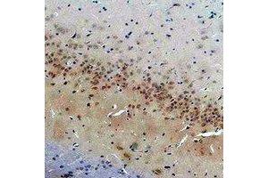 Immunohistochemical analysis of CACNG2 staining in rat brain formalin fixed paraffin embedded tissue section. (Stargazin anticorps)