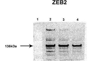 ZEB2 antibody - middle region  validated by WB using H9 human embryonic stem cells at 1:1000.