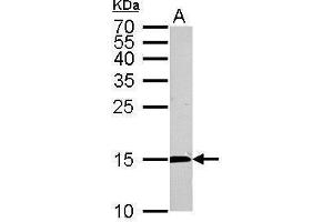 WB Image CDA antibody detects CDA protein by Western blot analysis.
