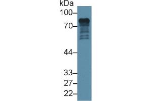 Detection of EPN1 in Mouse Cerebrum lysate using Polyclonal Antibody to Epsin 1 (EPN1)
