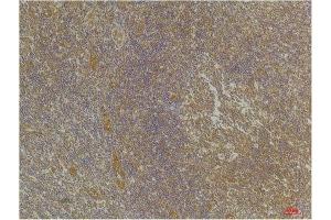 Immunohistochemistry (IHC) analysis of paraffin-embedded Human Tonsil Tissue using CXCR4 Rabbit Polyclonal Antibody diluted at 1:200. (CXCR4 anticorps)