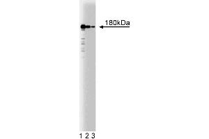 Western blot analysis of Clathrin Heavy Chain on HeLa cell lysate (center). (Clathrin anticorps  (AA 4-171))