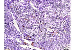 Formalin-fixed and paraffin embedded mouse endometrium tissue labeled with Anti-ECM1 Polyclonal Antibody, Unconjugated (ABIN673071) at 1:300, followed by conjugation to the secondary antibody and DAB staining (ECM1 anticorps  (AA 488-567))