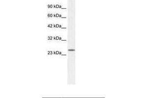 Image no. 2 for anti-Zinc Finger, AN1-Type Domain 6 (ZFAND6) (AA 125-174) antibody (ABIN202067)