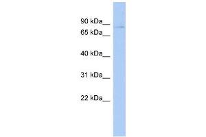 WB Suggested Anti-PHF17 Antibody Titration:  0. (PHF17 anticorps  (Middle Region))