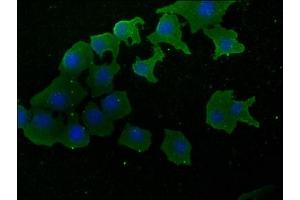 Immunofluorescence staining of A549 cells with ABIN7170322 at 1:50, counter-stained with DAPI. (SOS2 anticorps  (AA 187-404))