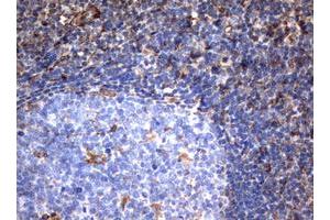 Image no. 2 for anti-Vimentin (VIM) (AA 210-466) antibody (ABIN1491200)