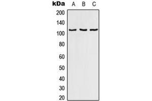Western blot analysis of RAB3GAP1 expression in HeLa (A), SP2/0 (B), PC12 (C) whole cell lysates. (RAB3GAP1 anticorps  (Center))