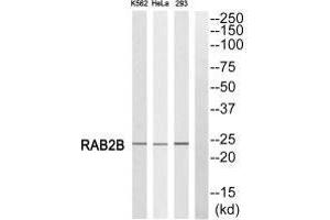 Western blot analysis of extracts from K562 cells, HeLa cells and 293 cells, using RAB2B antibody. (RAB2B anticorps)