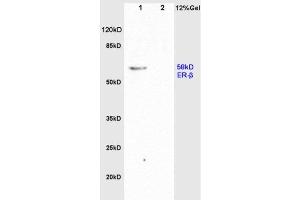 L1 rat brain, L2 rat colon lysates probed  at 1:200 in 4˚C. (Estrogen Receptor alpha + beta (AA 201-300) anticorps)