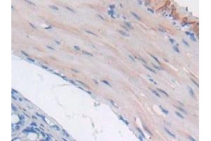 Detection of GaA in Mouse Small intestine Tissue using Polyclonal Antibody to Glucosidase Alpha, Acid (GaA) (GAA anticorps  (AA 755-953))