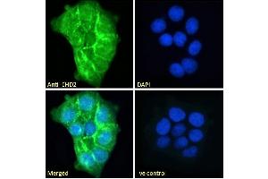ABIN185287 Immunofluorescence analysis of paraformaldehyde fixed A431 cells, permeabilized with 0. (EHD2 anticorps  (C-Term))