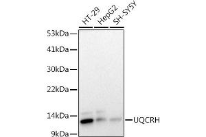 Western blot analysis of extracts of various cell lines, using (ABIN7271126) at 1:1000 dilution. (UQCRH anticorps)