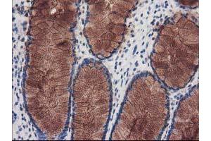Immunohistochemical staining of paraffin-embedded Human colon tissue using anti-KATNB1 mouse monoclonal antibody. (KATNB1 anticorps)
