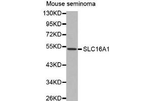 Western Blotting (WB) image for anti-Solute Carrier Family 16, Member 1 (Monocarboxylic Acid Transporter 1) (SLC16A1) antibody (ABIN3017184)