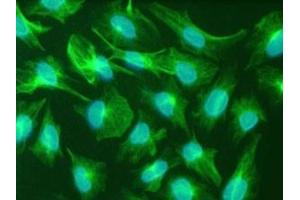 Immunfluorescence staining of the human glioma cell line U251. (Nestin anticorps)