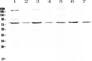 Western blot analysis of MST1 using anti-MST1 antibody .