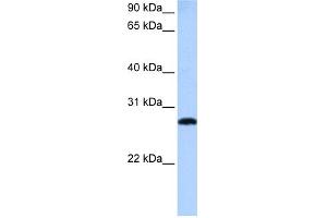WB Suggested Anti-MLX Antibody Titration:  0.