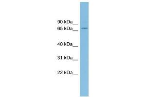 EIF4B antibody used at 1 ug/ml to detect target protein. (EIF4B anticorps  (Middle Region))