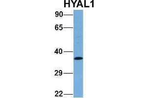 Host:  Rabbit  Target Name:  HYAL1  Sample Type:  Human Fetal Lung  Antibody Dilution:  1. (HYAL1 anticorps  (N-Term))