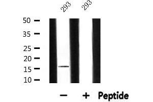 Western blot analysis of extracts from 293, using MRPL14 Antibody. (MRPL14 anticorps  (C-Term))
