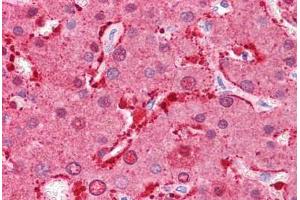 Human Liver: Formalin-Fixed, Paraffin-Embedded (FFPE)