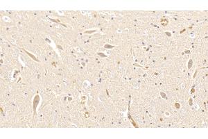 Detection of HB in Canine Spinal cord Tissue using Polyclonal Antibody to Hemoglobin (HB) (Hemoglobin anticorps)