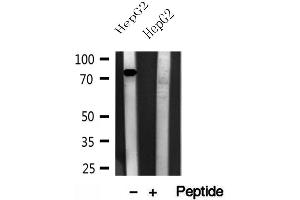 Western blot analysis of extracts of HepG2 cells, using CPT1A antibody.
