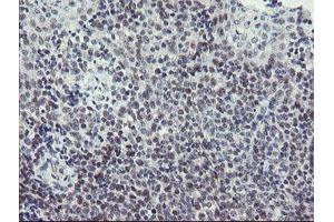 Image no. 4 for anti-SUMO1/sentrin/SMT3 Specific Peptidase 2 (SENP2) (AA 139-523) antibody (ABIN1490931) (SENP2 anticorps  (AA 139-523))