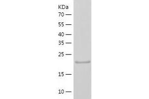 Western Blotting (WB) image for Protein tyrosine Phosphatase, Receptor Type, C (PTPRC) (AA 1031-1251) protein (His-IF2DI Tag) (ABIN7124684)