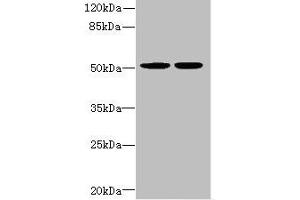 Western blot All lanes: MATK antibody at 5. (MATK anticorps  (AA 393-507))