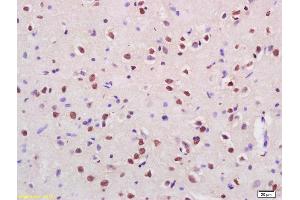 Formalin-fixed and paraffin embedded rat brain labeled with Rabbit Anti Cux2 Polyclonal Antibody, Unconjugated (ABIN1386279) at 1:200 followed by conjugation to the secondary antibody and DAB staining