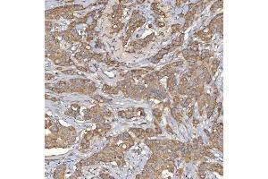 IHC analysis of Mitochondrial Dicarboxylate Carrier/SLC25A10 using anti-Mitochondrial Dicarboxylate Carrier/SLC25A10 antibody (ABIN7601497).
