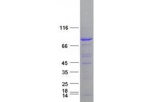 Validation with Western Blot