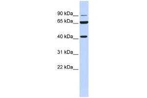 H6PD antibody used at 1 ug/ml to detect target protein. (Glucose-6-Phosphate Dehydrogenase anticorps)