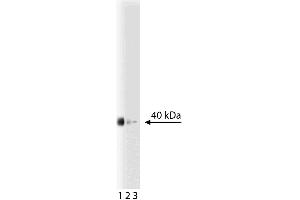Western blot analysis of prostasin on a LNCaP-FGC-10 (human prostate cancer cell line) lysate. (PRSS8 anticorps  (AA 108-228))