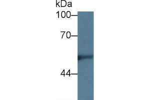 Western blot analysis of Human Hela cell lysate, using Rabbit Anti-Rat KNG1 Antibody (5 µg/ml) and HRP-conjugated Goat Anti-Rabbit antibody (abx400043, 0. (KNG1 anticorps  (AA 19-380))