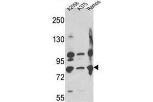 Western blot analysis of Neprilysin Antibody (C-term) in A2058,A375,Ramos cell line lysates (35ug/lane). (MME anticorps  (C-Term))