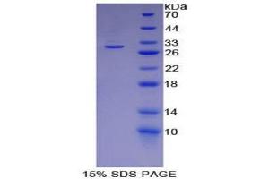 SDS-PAGE (SDS) image for Basigin (Ok Blood Group) (BSG) (AA 87-323) protein (His tag,T7 tag) (ABIN1879117)